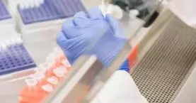 Cocaine Detection: How Long Cocaine Stays in the System