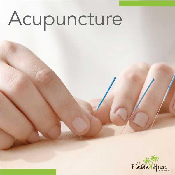 Acupuncture at FHE