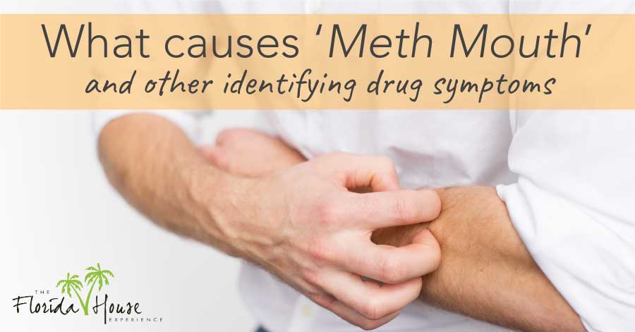 What are other indicators of drug use like meth mouth