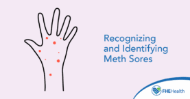 What are Meth Sores