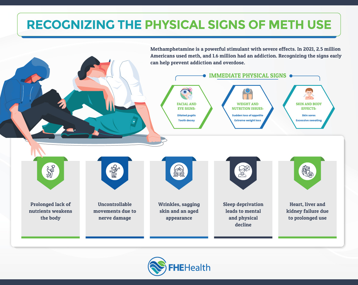 The signs of meth use to spot